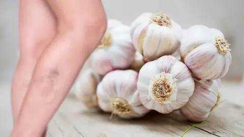 Remedios para varices