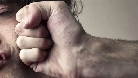 Hombre da pu&ntilde;etazo en la cara a otro