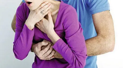 Mujer atragantada con un trozo de carne