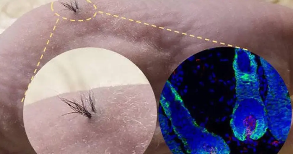 Foto: Sanford Burnham Preybs