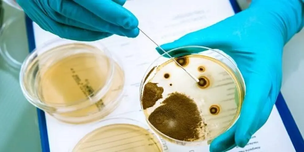 Germs growing on an agar plate in laboratory