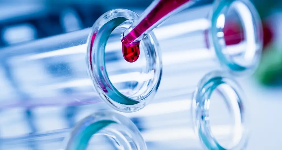 Pipette adding fluid to one of several test tubes .medical glassware