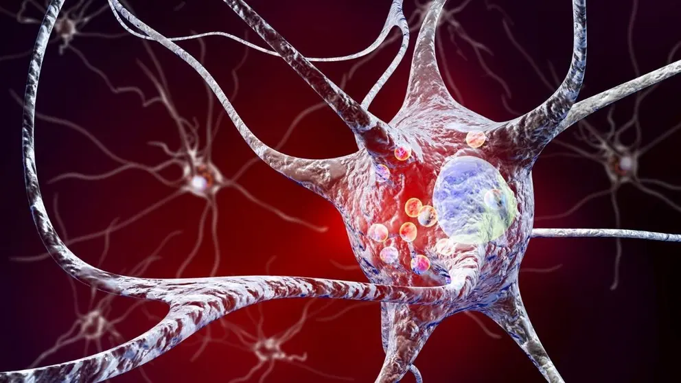 Conexi&oacute;n neuronal Parkinson