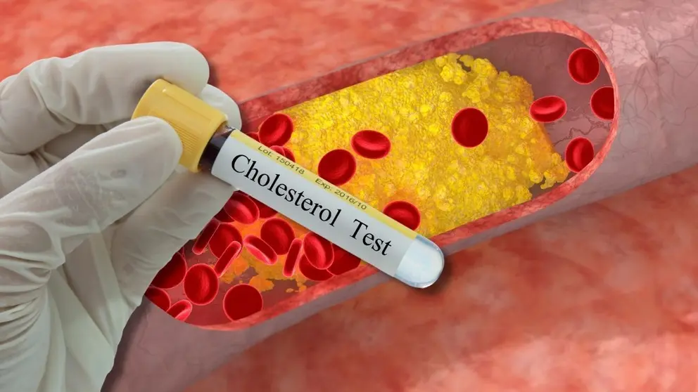 Test de Colesterol