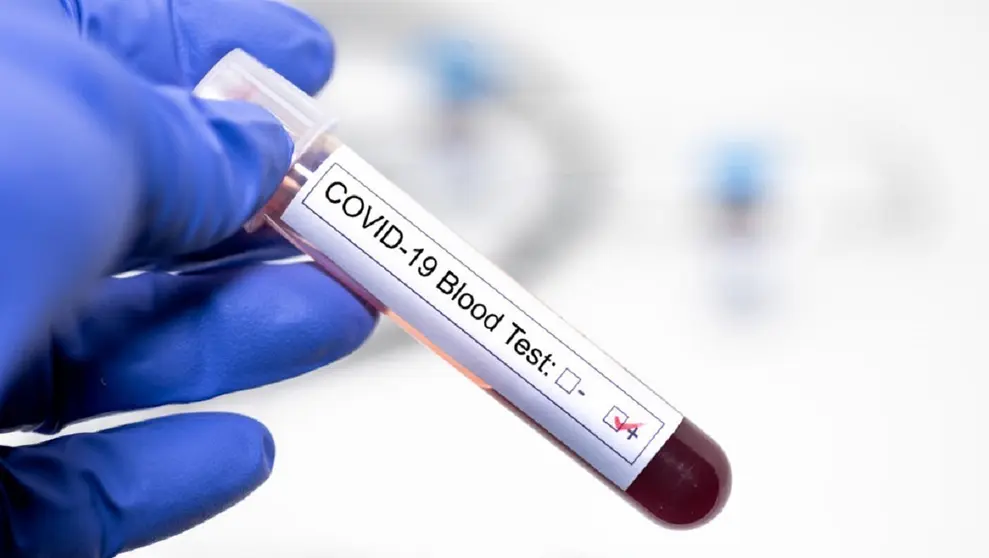 Test positivo en Coronavirus