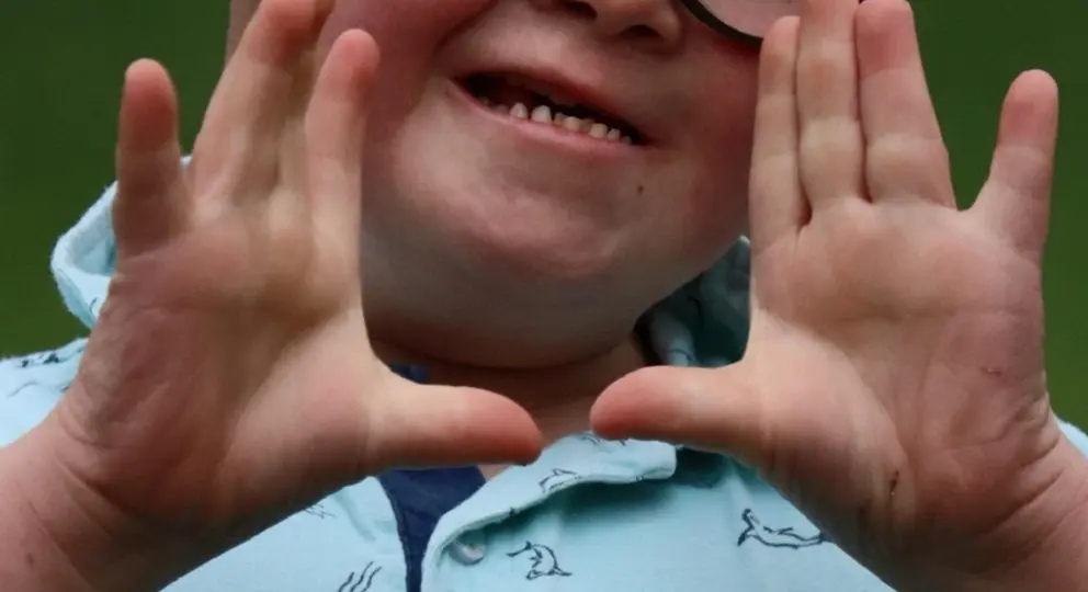 Ni&ntilde;o con s&iacute;ndrome de down