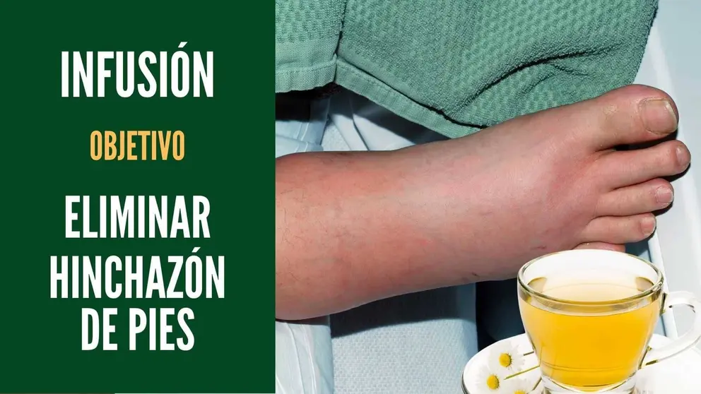 Infusi&oacute;n con la que eliminar&aacute;s la hinchaz&oacute;n de pies