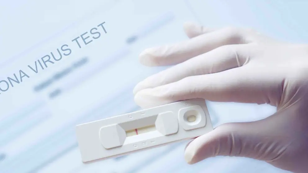 Test de autodiagn&oacute;stico de Covid-19
