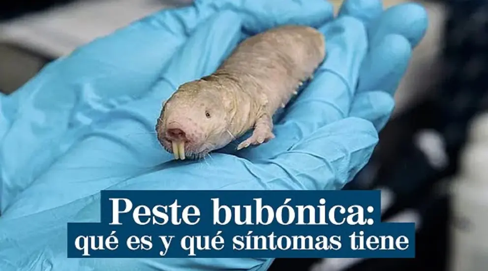 La peste bub&oacute;nica se ha cobrado la vida de una ni&ntilde;a