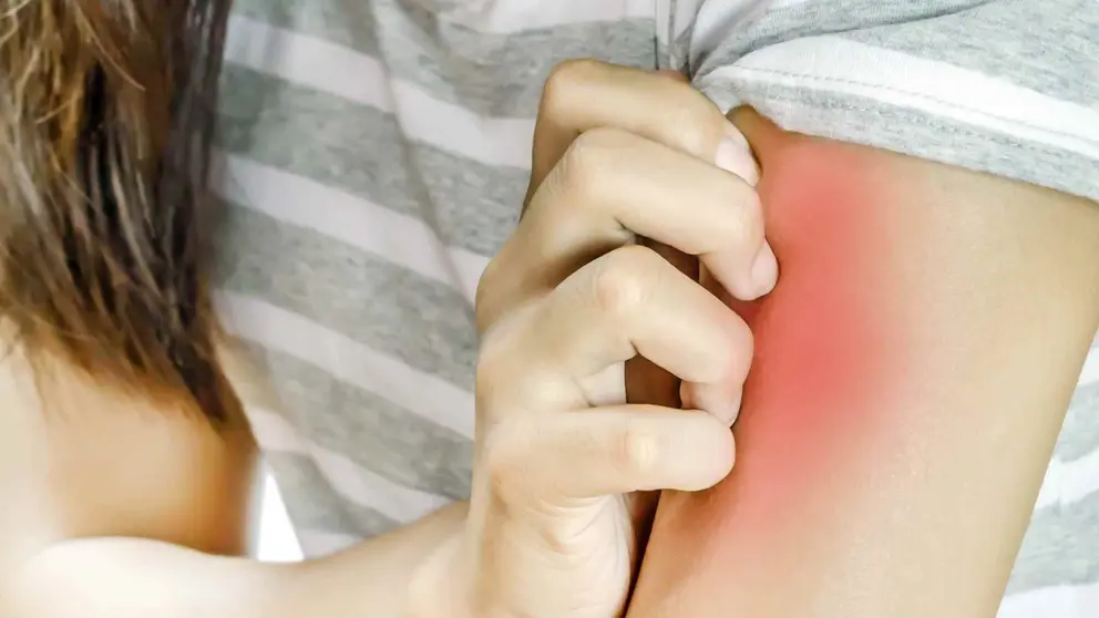 El motivo de que algunas alergias desaparecen solas con el paso de los a&ntilde;os