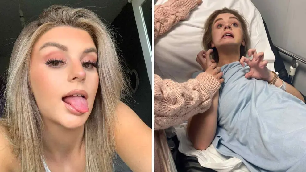 Millie Tapplin, joven paralizada por una droga