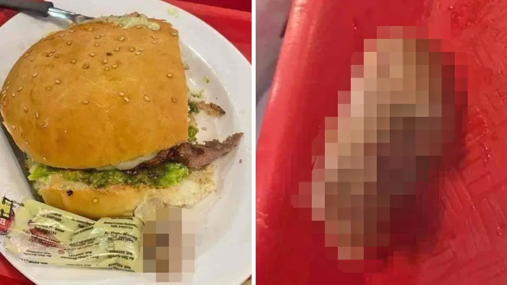 Encuentra un dedo humano en la hamburguesa que se estaba comiendo&nbsp;