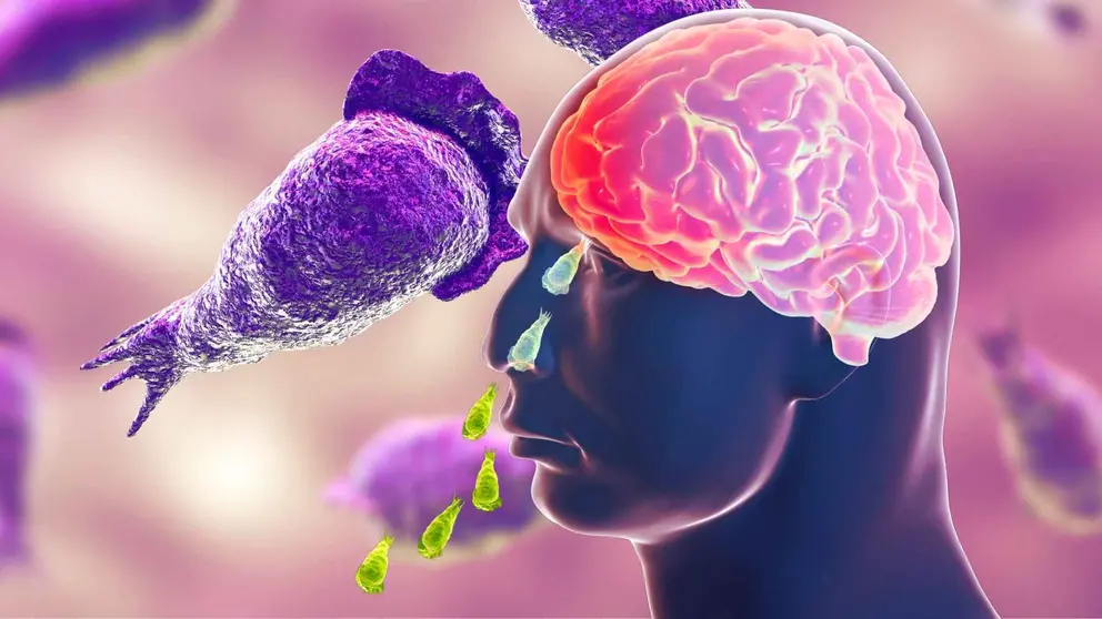 Muere un ni&ntilde;o por una ameba 'come cerebros' en un parque acu&aacute;tico