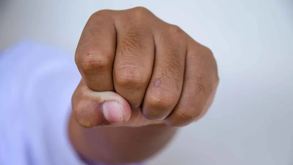 Rompe varios dientes a un menor en Algeciras a las puertas de una discoteca en una agresi&oacute;n hom&oacute;foba