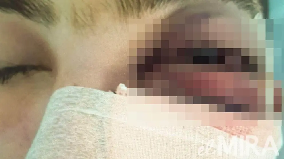 La agresi&oacute;n en Jerez del joven Andr&eacute;s con discapacidad intelectual es un caso de discafobia -px