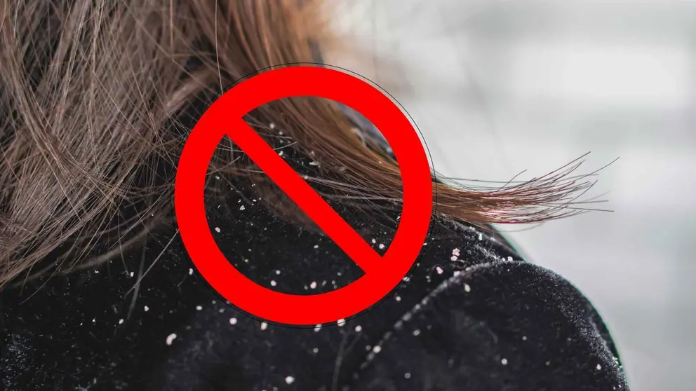 Este champ&uacute; anticaspa es favorito entre los clientes del Mercadona