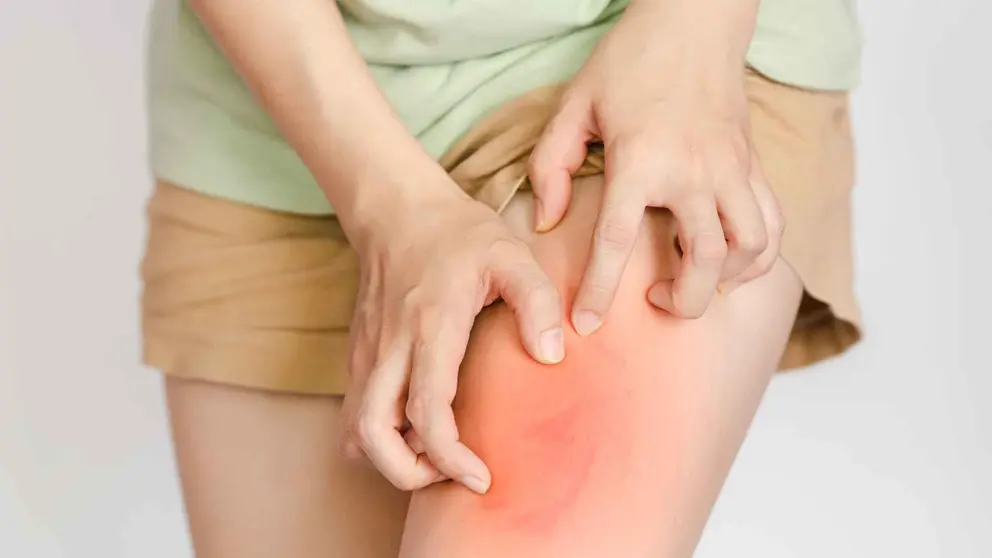 Crema antirozaduras APTONIA de Decathlon