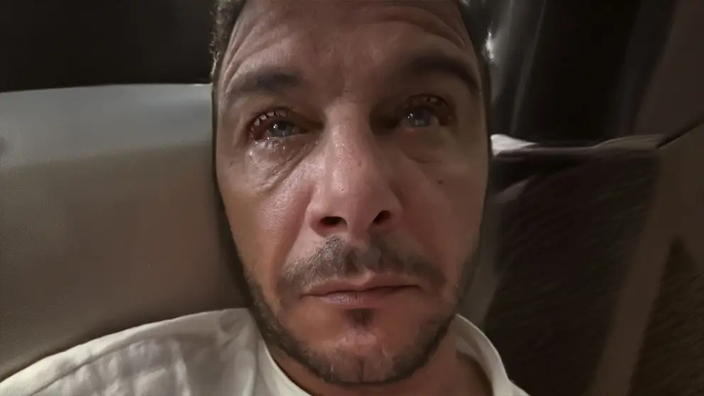 Joaqu&iacute;n S&aacute;nchez con conjuntivitis