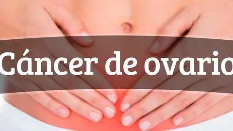 Cada d&iacute;a se detectan m&aacute;s de 10 casos de c&aacute;ncer de ovarios en Espa&ntilde;a