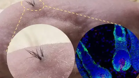 Foto: Sanford Burnham Preybs