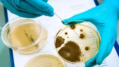 Germs growing on an agar plate in laboratory