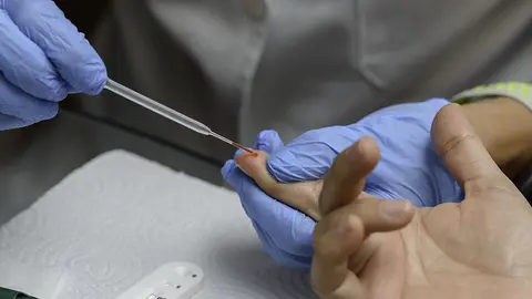 PCR contra el Covid-19