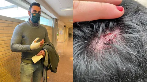 Agresi&oacute;n a un miembro de Vox en Barcelona