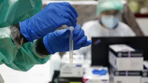 Un test de Coronavirus