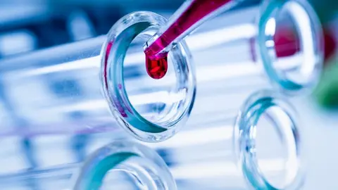 Pipette adding fluid to one of several test tubes .medical glassware