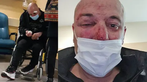 V&iacute;ctima de la pelea en Linares