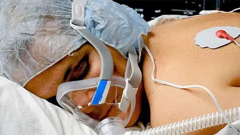 El Coronavirus se manifiesta de forma muy grave en ciertos pacientes