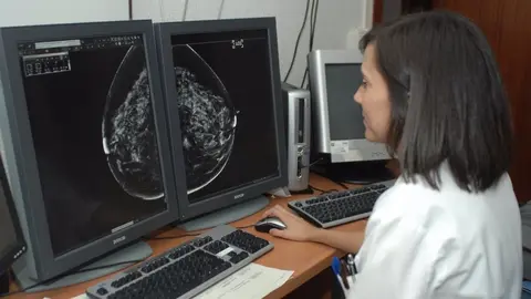 Radiograf&iacute;a de una mamograf&iacute;a