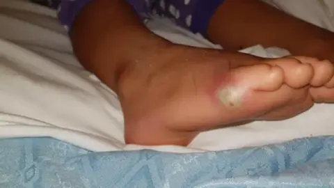 La sepsis ha provocado la muerte a un ni&ntilde;o de cuatro a&ntilde;os