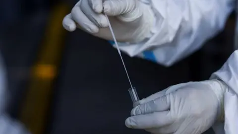 La precisi&oacute;n de una prueba PCR puede venir marcada por la hora a la que se realice