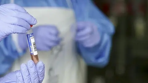 La cepa brasile&ntilde;a ha llegado a Andaluc&iacute;a