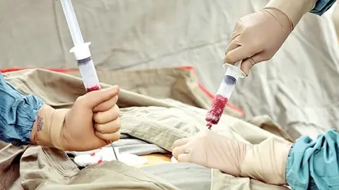 Trasplante de m&eacute;dula &oacute;sea