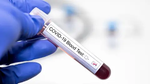 Test positivo en Coronavirus