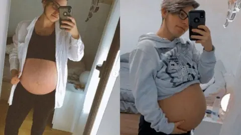 El primer hombre embarazado de Espa&ntilde;a