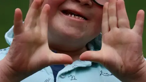 Ni&ntilde;o con s&iacute;ndrome de down