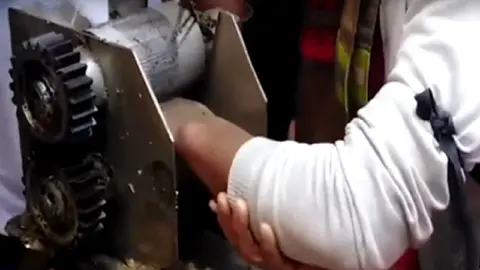 Mano atrapada en una m&aacute;quina