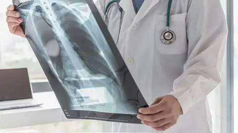 Doctor with radiological chest x-ray film for medical diagnosis on patient's health on asthma, lung disease and bone cancer illness (Doctor with radiological chest x-ray film for medical diagnosis on patient's health on asthma, lung disease and bo