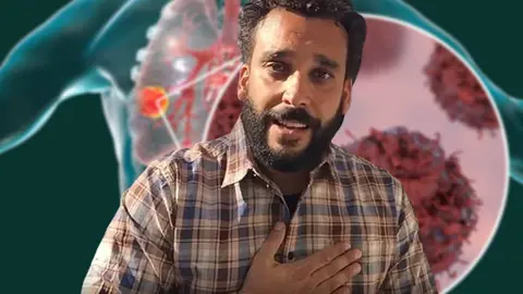 El c&aacute;ncer de Spiriman