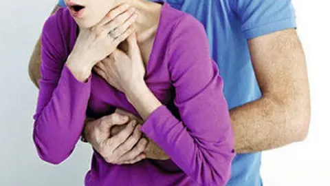 Mujer atragantada con un trozo de carne