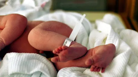 Un beb&eacute; ha sufrido un corte en la cara tras la ces&aacute;rea