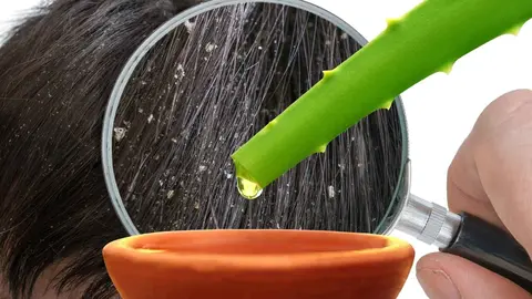 4 remedios naturales que puedes encontrar en cualquier supermercado para eliminar la caspa