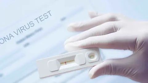 Test de autodiagn&oacute;stico de Covid-19