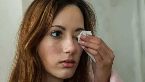 Cuidado al usar manzanilla para limpiar tus ojos, estas son las contraindicaciones