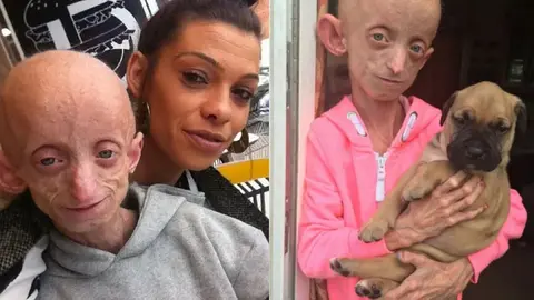 La joven de 18 a&ntilde;os ha muerto con el aspecto de una anciana de 144