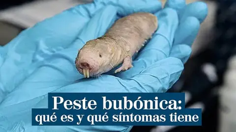 La peste bub&oacute;nica se ha cobrado la vida de una ni&ntilde;a