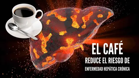 Investigaci&oacute;n en Reino Unido asegura que el caf&eacute; se asocia con menor riesgo de enfermedad hep&aacute;tica cr&oacute;nica